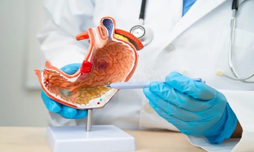 Stomach Specialists